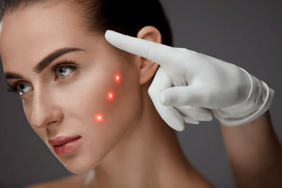 fiatalító módszerek